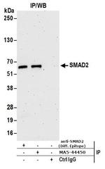 SMAD2 Antibody in Immunoprecipitation (IP)