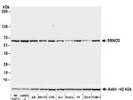 SMAD2 Antibody in Western Blot (WB)