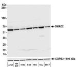 SMAD2 Antibody in Western Blot (WB)