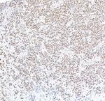 FOXP1 Antibody in Immunohistochemistry (Paraffin) (IHC (P))