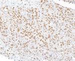 FOXP1 Antibody in Immunohistochemistry (Paraffin) (IHC (P))