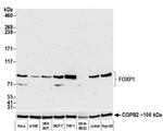 FOXP1 Antibody in Western Blot (WB)