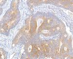 MACC1 Antibody in Immunohistochemistry (Paraffin) (IHC (P))