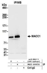 MACC1 Antibody in Immunoprecipitation (IP)