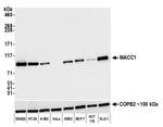 MACC1 Antibody in Western Blot (WB)