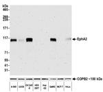 EphA2 Antibody in Western Blot (WB)