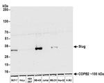 SLUG Antibody in Western Blot (WB)