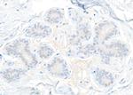 STAT5 beta Antibody in Immunohistochemistry (Paraffin) (IHC (P))