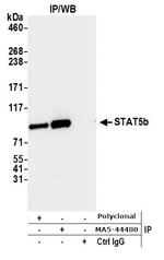 STAT5 beta Antibody in Immunoprecipitation (IP)