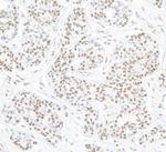 STAT6 Antibody in Immunohistochemistry (Paraffin) (IHC (P))