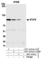 STAT6 Antibody in Immunoprecipitation (IP)