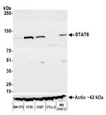 STAT6 Antibody in Western Blot (WB)