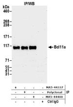 BCL11A Antibody in Immunoprecipitation (IP)