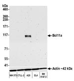 BCL11A Antibody in Western Blot (WB)