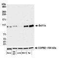 BCL11A Antibody in Western Blot (WB)