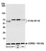 CD275 (B7-H2) Antibody in Western Blot (WB)