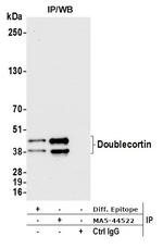 Doublecortin Antibody in Immunoprecipitation (IP)