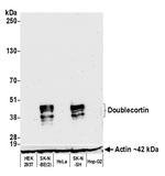 Doublecortin Antibody in Western Blot (WB)