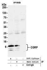 CGRP Antibody in Immunoprecipitation (IP)