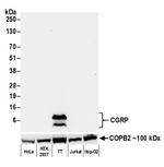 CGRP Antibody in Western Blot (WB)