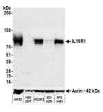 IL18R1 Antibody in Western Blot (WB)