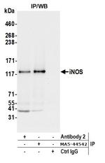 iNOS Antibody in Immunoprecipitation (IP)