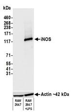 iNOS Antibody in Western Blot (WB)