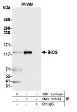 iNOS Antibody in Immunoprecipitation (IP)