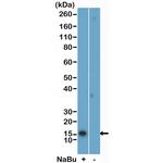 H2BK5ac Antibody in Western Blot (WB)