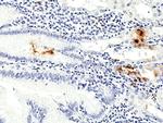 Helicobacter pylori Antibody in Immunohistochemistry (Paraffin) (IHC (P))