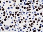 H3 K36M oncohistone mutant Antibody in Immunocytochemistry (ICC/IF)