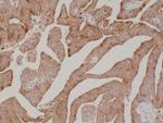 PSA Antibody in Immunohistochemistry (Paraffin) (IHC (P))