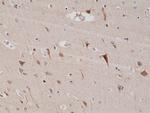 PSD-95 Antibody in Immunohistochemistry (Paraffin) (IHC (P))