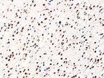 IDH1 (R132H) Antibody in Immunohistochemistry (Paraffin) (IHC (P))