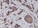 Cytokeratin 8 Antibody in Immunohistochemistry (Paraffin) (IHC (P))