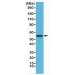 Cytokeratin 8 Antibody in Western Blot (WB)