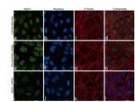 NSD1 Antibody in Immunocytochemistry (ICC/IF)