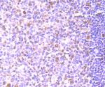 PTBP1 Antibody in Immunohistochemistry (Paraffin) (IHC (P))