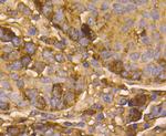 Tyrosinase Antibody in Immunohistochemistry (Paraffin) (IHC (P))