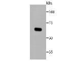 Tyrosinase Antibody in Western Blot (WB)