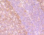 gamma Tubulin Antibody in Immunohistochemistry (Paraffin) (IHC (P))