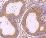 gamma Tubulin Antibody in Immunohistochemistry (Paraffin) (IHC (P))