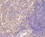 Cyclin A2 Antibody in Immunohistochemistry (Paraffin) (IHC (P))