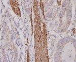 Desmin Antibody in Immunohistochemistry (Paraffin) (IHC (P))