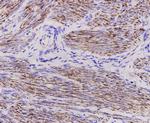 Desmin Antibody in Immunohistochemistry (Paraffin) (IHC (P))