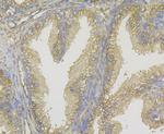 ERK2 Antibody in Immunohistochemistry (Paraffin) (IHC (P))