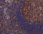 beta Tubulin Antibody in Immunohistochemistry (Paraffin) (IHC (P))