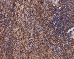 beta Tubulin Antibody in Immunohistochemistry (Paraffin) (IHC (P))