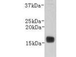 Transthyretin Antibody in Western Blot (WB)