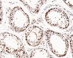 JMJD1B Antibody in Immunohistochemistry (Paraffin) (IHC (P))